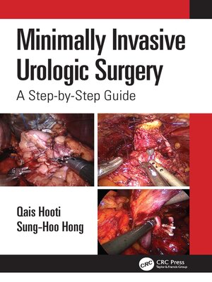 cover image of Minimally Invasive Urologic Surgery